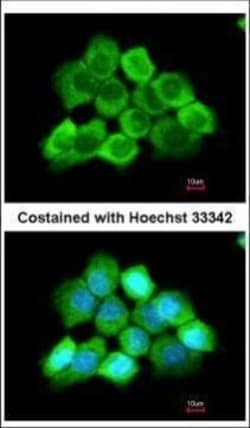 Invitrogen CENTG3 Polyclonal Antibody 100 &mu;L; Unconjugated:Antibodies,