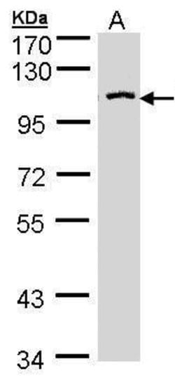 Invitrogen CENTG3 Polyclonal Antibody 100 &mu;L; Unconjugated:Antibodies,