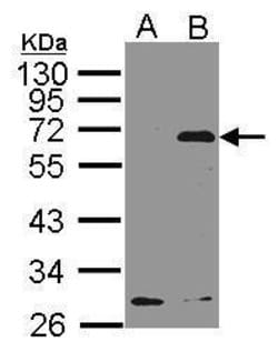 Invitrogen NET1 Polyclonal Antibody 100 &mu;L; Unconjugated:Antibodies,