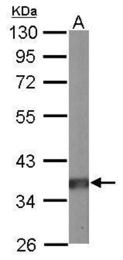 Invitrogen PP2A alpha Polyclonal Antibody 100 &mu;L; Unconjugated:Antibodies,