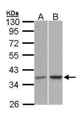 Invitrogen PP2A alpha Polyclonal Antibody 100 &mu;L; Unconjugated:Antibodies,