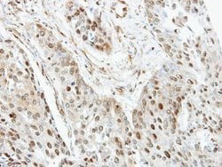 Invitrogen RANGAP1 Polyclonal Antibody 100 &mu;L; Unconjugated:Antibodies,