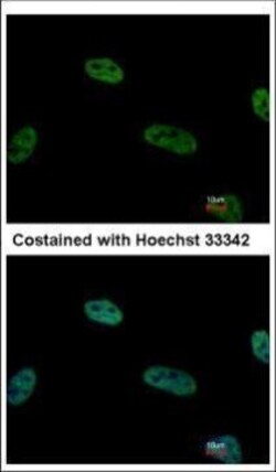Invitrogen TRIP15 Polyclonal Antibody 100 &mu;L | Buy Online | Invitrogen&trade; | Fisher Scientific
