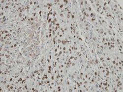 Invitrogen TRIP15 Polyclonal Antibody 100 &mu;L; Unconjugated:Antibodies,
