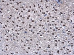 Invitrogen TRIP15 Polyclonal Antibody 100 &mu;L; Unconjugated:Antibodies,