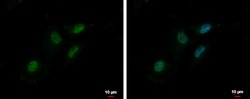 Invitrogen MTA2 Polyclonal Antibody 100 μL; Unconjugated:Antibodies,