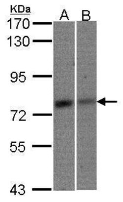 Invitrogen MTA2 Polyclonal Antibody 100 μL; Unconjugated:Antibodies,