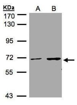 CDYL Polyclonal Antibody, Invitrogen 100 &mu;L; Unconjugated:Antibodies,
