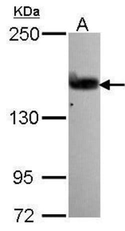 Invitrogen GEF5 Polyclonal Antibody 100 &mu;L | Buy Online | Invitrogen&trade; | Fisher Scientific