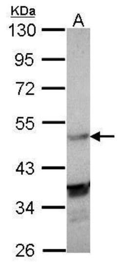 Invitrogen LXR alpha Polyclonal Antibody 100 &mu;L; Unconjugated:Antibodies,