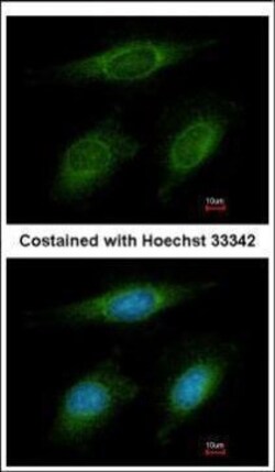 Invitrogen RNF6 Polyclonal Antibody 100 &mu;L; Unconjugated:Antibodies,