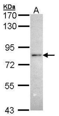 Invitrogen RNF6 Polyclonal Antibody 100 &mu;L; Unconjugated:Antibodies,
