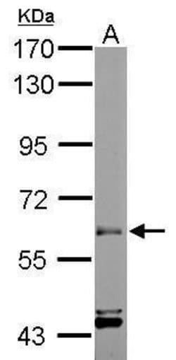 Invitrogen ARIH2 Polyclonal Antibody 100 &mu;L; Unconjugated:Antibodies,