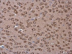 Invitrogen Coronin 1A Polyclonal Antibody 100 &mu;L; Unconjugated:Antibodies,
