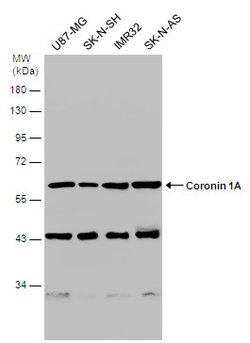 Invitrogen Coronin 1A Polyclonal Antibody 100 &mu;L; Unconjugated:Antibodies,