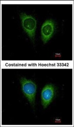 Invitrogen FSTL1 Polyclonal Antibody 100 &mu;L; Unconjugated:Antibodies,