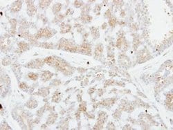 Invitrogen FSTL1 Polyclonal Antibody 100 &mu;L; Unconjugated:Antibodies,