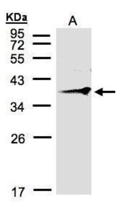Invitrogen RNF2 Polyclonal Antibody 100 &mu;L | Buy Online | Invitrogen&trade; | Fisher Scientific