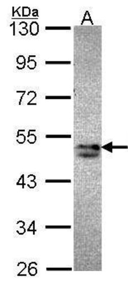 Invitrogen SNX15 Polyclonal Antibody 100 &mu;L; Unconjugated:Antibodies,