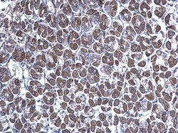 Invitrogen GGA3 Polyclonal Antibody 100 &mu;L; Unconjugated:Antibodies,