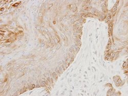 Invitrogen GGA3 Polyclonal Antibody 100 &mu;L; Unconjugated:Antibodies,