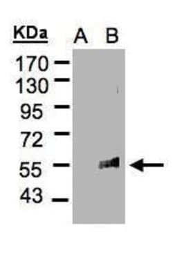Invitrogen&trade;&nbsp;FLVCR1 Polyclonal Antibody