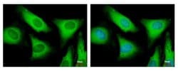 Invitrogen eIF2 beta Polyclonal Antibody 100 μL; Unconjugated:Antibodies,
