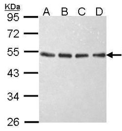 Invitrogen eIF2 beta Polyclonal Antibody 100 μL; Unconjugated:Antibodies,