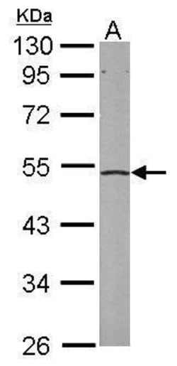 Invitrogen eIF2 beta Polyclonal Antibody 100 μL; Unconjugated:Antibodies,