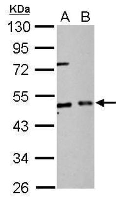 Invitrogen eIF2 beta Polyclonal Antibody 100 μL; Unconjugated:Antibodies,