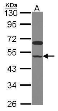 Invitrogen GRINL1A Polyclonal Antibody 100 &mu;L; Unconjugated:Antibodies,