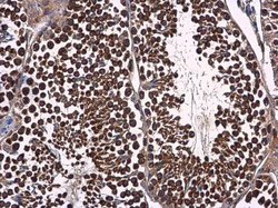 Invitrogen p23 Polyclonal Antibody 100 &mu;L; Unconjugated:Antibodies,