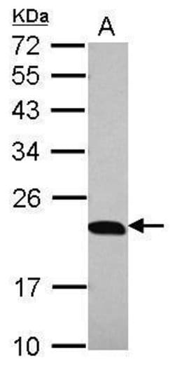 Invitrogen p23 Polyclonal Antibody 100 &mu;L; Unconjugated:Antibodies,
