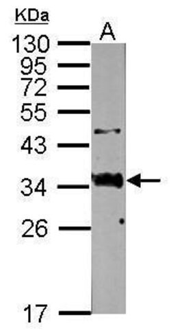 Invitrogen SFTPA1 Polyclonal Antibody 100 &mu;L; Unconjugated:Antibodies,