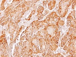 Invitrogen ERP44 Polyclonal Antibody 100 &mu;L; Unconjugated:Antibodies,
