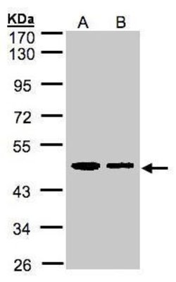 Invitrogen ERP44 Polyclonal Antibody 100 &mu;L; Unconjugated:Antibodies,