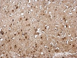 Invitrogen SKP1 Polyclonal Antibody 100 &mu;L; Unconjugated:Antibodies,