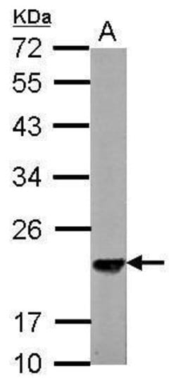 Invitrogen SKP1 Polyclonal Antibody 100 &mu;L; Unconjugated:Antibodies,