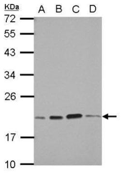 Invitrogen SKP1 Polyclonal Antibody 100 &mu;L; Unconjugated:Antibodies,