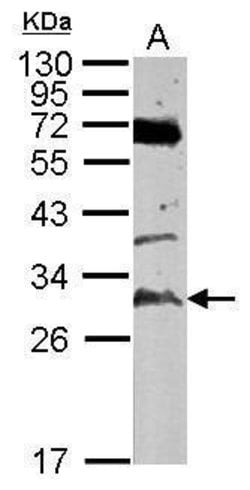 Invitrogen TATDN3 Polyclonal Antibody 100 &mu;L; Unconjugated:Antibodies,