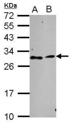 Invitrogen TATDN3 Polyclonal Antibody 100 &mu;L; Unconjugated:Antibodies,