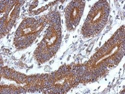 Invitrogen CCDC37 Polyclonal Antibody 100 &mu;L; Unconjugated:Antibodies,