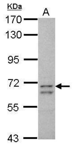 Invitrogen CCDC37 Polyclonal Antibody 100 &mu;L; Unconjugated:Antibodies,
