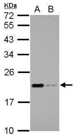 Invitrogen Apolipoprotein M Polyclonal Antibody 100 &mu;L; Unconjugated:Antibodies,