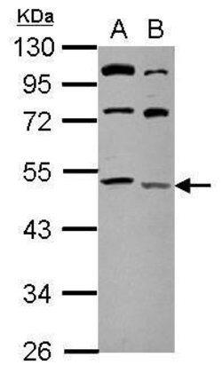 Invitrogen LCLAT1 Polyclonal Antibody 100 &mu;L | Buy Online | Invitrogen&trade; | Fisher Scientific
