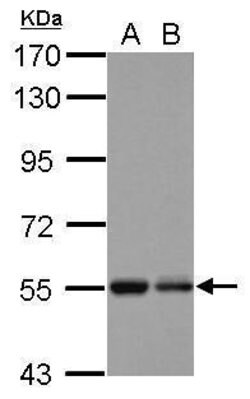 Invitrogen KBTBD4 Polyclonal Antibody 100 &mu;L; Unconjugated:Antibodies,