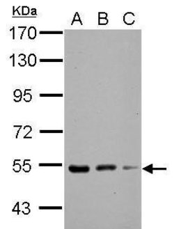 Invitrogen KBTBD4 Polyclonal Antibody 100 &mu;L; Unconjugated:Antibodies,