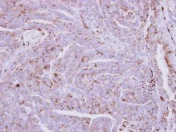 Invitrogen ZDHHC11 Polyclonal Antibody 100 &mu;L; Unconjugated:Antibodies,
