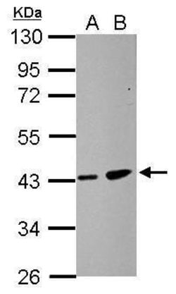 Invitrogen ZDHHC11 Polyclonal Antibody 100 &mu;L; Unconjugated:Antibodies,