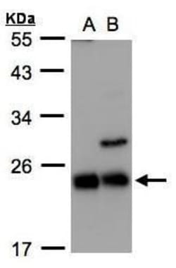 Invitrogen CBF beta Polyclonal Antibody 100 &mu;L; Unconjugated:Antibodies,